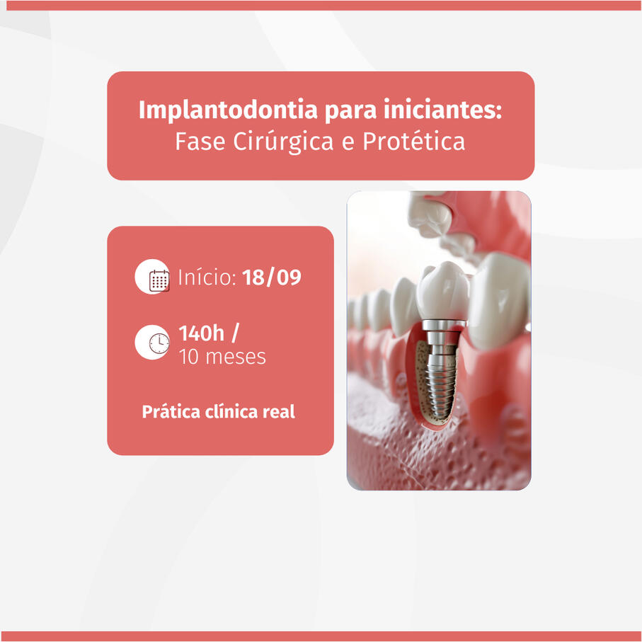 Implantodontia para iniciantes: Fase Cirúrgica e Protética